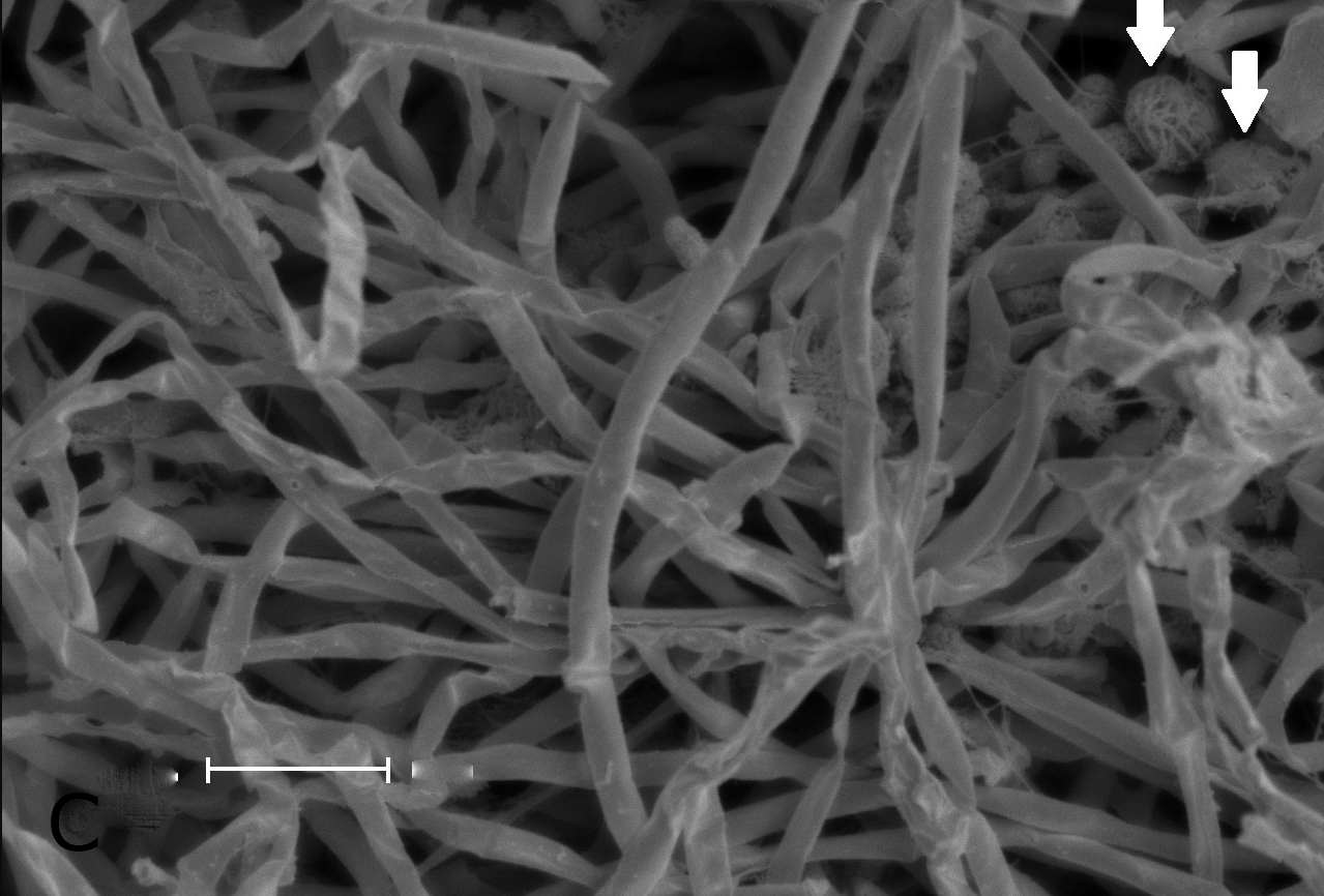 Bacteria.jpg