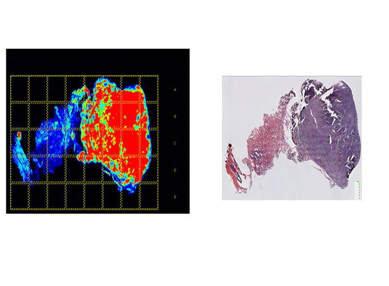Tumor-Paint-Image_H&E.jpg
